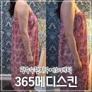 메디365 | 광주웨딩관리 수완지구에스테틱 365메디스킨 후기｜팔뚝·승모 라인 집중 케어