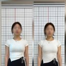 72-2전방마트 | 오목교 필라테스 온리원핏, 다리 꼬는 사무직 직장인 거북목&골반 전방경사 리얼 교정 후기