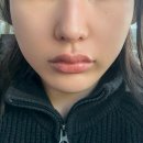 한결한의원 | 서면턱관절교정 한의원 치료로 불균형부터 통증까지 좋아지는 후기!