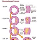 혈관을 청소하여 고혈압을 이겨내는 식이요법 이미지