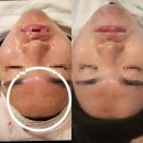 자연미인 에스테틱 이미지