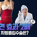 지방흡입 효과 2배! 가성비 높은 지방흡입 지방이식? | 압구정탑라인의원 변상국대표원장