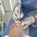 레푸스 연산점 이미지