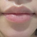 피부관리·경락(수) | 강동구 경락 강동구 피부관리 장지희 피부경락 후기