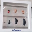 현대 독일보청기 의료기 | 밀양보청기 밀양서울보청기 청력을 향상시키고 스트레스 완화 방법!