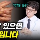 영양결핍 환자 급증! 아이러니한 한국의 상황. 배부르게 먹지만 영양이 부족하다. 약사도 놀란 한국인 영양실조 이미지