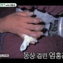 자칫 동상으로 이어질 수 있는 겨울철 산행, 어떻게 해야 안전할까? 이미지