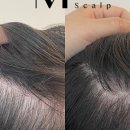 미라클뷰티&더모어스칼프 네이버블로그