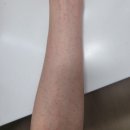 가야한의원 | 4. 편두통은 어디 병원을 가야 할까? 대학병원, 개인병원, 한의원 후기