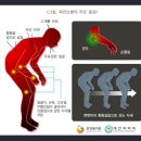 뇌졸중 진단비와 파킨슨병 진단비의 비교 이미지