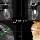 다산바른치과의원 이미지