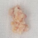 강서고려비뇨의학과의원 | 홀렙+리줌시술 후기, 일주일만에 좋아진 71세 환자 사례