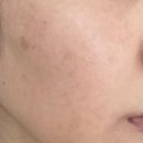 감초약국 | 약국 착색크림 기초 관리의 중요성