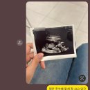 힘내라병원 | 기형아검사 다운증후군 고위험군 양수검사 후기, 평택 시험관 예일아이난임센터