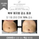 원테라피 이미지