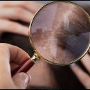 햇빛헤어라인 - 북구 | 헤어라인 교정 후기 잘 살펴보고 선택