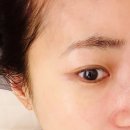 비나인에스테틱 이미지