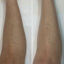 어반유 | 부산 서면 바디왁싱(다리하프) 추천 어반유 방문후기