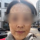 JNL에스테틱 | [면목역] JNL에스테틱 내돈내산 8회차 후기
