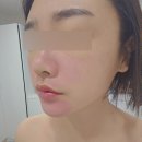 필 | [구월동 휘온 에스테틱] 트로이필 후기 ✨ 7일간 피부 변화 리얼체험기