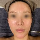 비비드봉 | 유명한 R4U 에너지테라피를 호매실피부샵 민에스테틱에서 받아요!