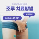 조루 치료의 옵션 이미지