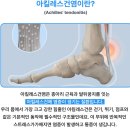 좋은운동 | 런닝 후 아킬레스건염에 좋은운동 pt후기 [안산 교정운동]