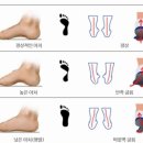 팔팔 두발로