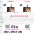 아이프로보청기 이미지