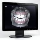 서울예다운치과의원 | 인생 치아 메이트 찾았다!! 더서울치과의원 방문 후기 레전드 각