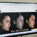 엘엔씨 | 루스킨엑스 AI 피부진단 후 리투오 Re20 스킨부스터 효과 본 후기
