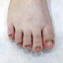 레푸스앤쓰담네일