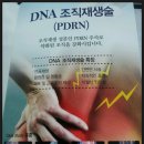 관절염에 획기적인 DNA주사 이미지