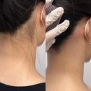오르다헤어 | 서면왁싱 여자 뒷목 왁싱 후기 더오르다뷰티 머리 묶어도 깔끔한 헤어라인