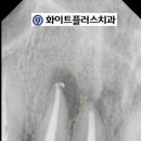 화이트플러스치과 이미지