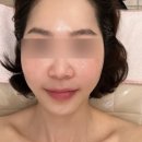 은평구 피부관리 화이트닝 모공축소관리 라멘떼은평뉴타운점