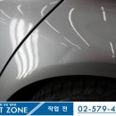 덴트존 이미지