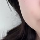 사랑니 빼기전에 사랑니 발치 후 1주일 후기 보고 가세요!