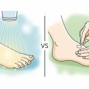 무좀 발톱 레이저 치료 vs 바르는 약 효과 비교 이미지