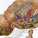 질병=질환(disease) 과 손상(injury) 4-6편 목 : 흉곽출구 증후군3 (Costoclavicular) 이미지