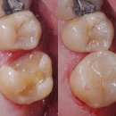 순치과기공소 이미지