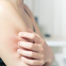 연세바른재활의학과의원 네이버블로그