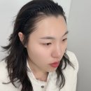 두피탈모관리가 필요할때 믿고가는 바이로마드 후기