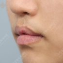 그림성형외과의원 네이버블로그