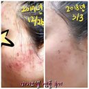 바이오셀 앰플 구매시♡ 제이부띠비비 증정♡