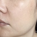 하얀민들레 | 탈리다쿰 화이트 단델리온(하얀 민들레) 에센스 수 2주 차 사용 후기