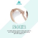 고릴라신경외과의원 이미지