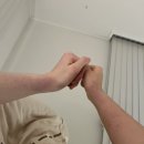 멍요일 | 배구하다 든 시퍼런 멍, 일주일 만에 벤트플라겔로 지운 후기