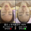 샐리에스테틱
