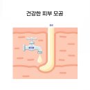 투앤티의원 | 아크리프 후기, 의사가 생각하는 효과 높이는 방법